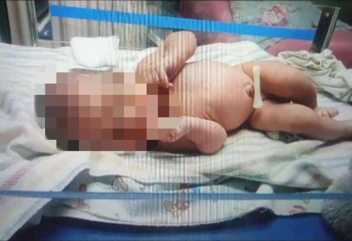 Kondisi bayi saat dirawat di Puskesmas Taman/ Foto : istimewa.
