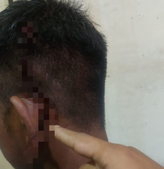 Kondisi luka-luka yang diderita korban / Foto : istimewa